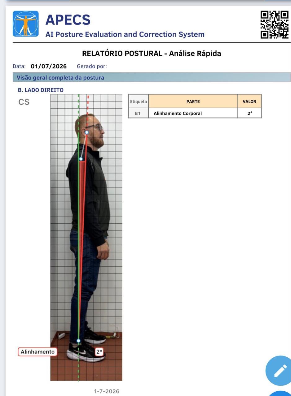 Exame de Avaliação Postural - Análise biomecânica na Anima Cura